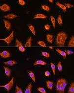 GSTP1 Antibody in Immunocytochemistry (ICC/IF)