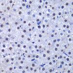 GSTP1 Antibody in Immunohistochemistry (Paraffin) (IHC (P))