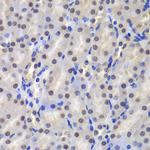 GSTP1 Antibody in Immunohistochemistry (Paraffin) (IHC (P))