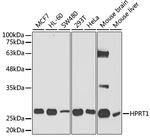 HPRT1 Antibody in Western Blot (WB)