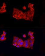 ROCK2 Antibody in Immunocytochemistry (ICC/IF)