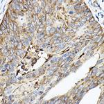 ROCK2 Antibody in Immunohistochemistry (Paraffin) (IHC (P))