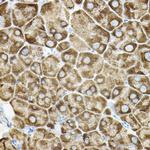 ROCK2 Antibody in Immunohistochemistry (Paraffin) (IHC (P))