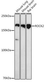 ROCK2 Antibody in Western Blot (WB)