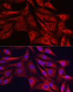 SIRT3 Antibody in Immunocytochemistry (ICC/IF)