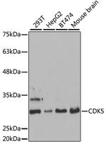 CDK5 Antibody in Western Blot (WB)