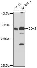 CDK5 Antibody in Western Blot (WB)