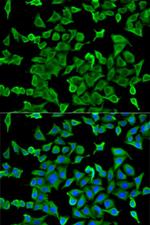 Arp2 Antibody in Immunocytochemistry (ICC/IF)