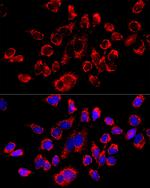 ATP Synthase beta Antibody in Immunocytochemistry (ICC/IF)