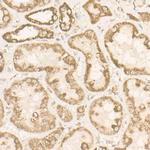 ATP Synthase beta Antibody in Immunohistochemistry (Paraffin) (IHC (P))