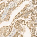 ATP Synthase beta Antibody in Immunohistochemistry (Paraffin) (IHC (P))