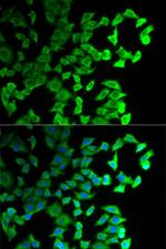 DIAPH1 Antibody in Immunocytochemistry (ICC/IF)