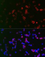 CD22 Antibody in Immunocytochemistry (ICC/IF)