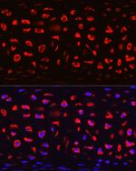 COMP Antibody in Immunohistochemistry (Paraffin) (IHC (P))