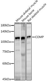 COMP Antibody in Western Blot (WB)