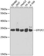 GTF2F2 Antibody in Western Blot (WB)