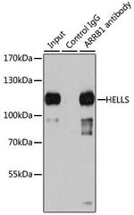 HELLS Antibody in Immunoprecipitation (IP)