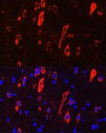 TrkC Antibody in Immunocytochemistry (ICC/IF)