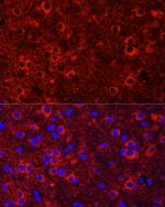 TrkC Antibody in Immunocytochemistry (ICC/IF)