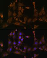 SND1 Antibody in Immunocytochemistry (ICC/IF)