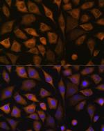 SND1 Antibody in Immunocytochemistry (ICC/IF)