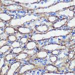 SND1 Antibody in Immunohistochemistry (Paraffin) (IHC (P))