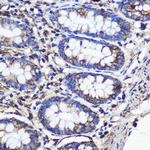 SND1 Antibody in Immunohistochemistry (Paraffin) (IHC (P))