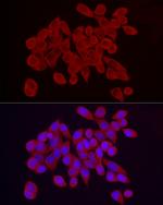 RPS10 Antibody in Immunocytochemistry (ICC/IF)