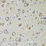 RPS10 Antibody in Immunohistochemistry (Paraffin) (IHC (P))