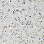 RPS10 Antibody in Immunohistochemistry (Paraffin) (IHC (P))