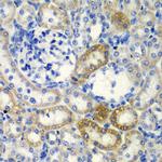 DCTD Antibody in Immunohistochemistry (Paraffin) (IHC (P))