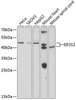 eIF2 beta Antibody in Western Blot (WB)