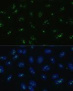 NOLC1 Antibody in Immunocytochemistry (ICC/IF)