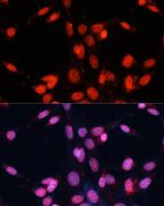 FUS Antibody in Immunocytochemistry (ICC/IF)