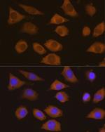 CSDE1 Antibody in Immunocytochemistry (ICC/IF)