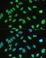 ALY Antibody in Immunocytochemistry (ICC/IF)