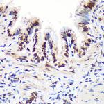 ALY Antibody in Immunohistochemistry (Paraffin) (IHC (P))