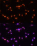 PRP8 Antibody in Immunocytochemistry (ICC/IF)