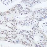 PRP8 Antibody in Immunohistochemistry (Paraffin) (IHC (P))