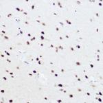 PRP8 Antibody in Immunohistochemistry (Paraffin) (IHC (P))