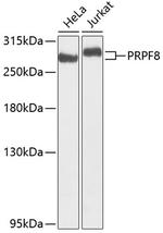 PRP8 Antibody in Western Blot (WB)