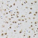 PTBP2 Antibody in Immunohistochemistry (Paraffin) (IHC (P))