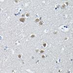 PTBP2 Antibody in Immunohistochemistry (Paraffin) (IHC (P))