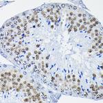 PTBP2 Antibody in Immunohistochemistry (Paraffin) (IHC (P))