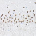 PTBP2 Antibody in Immunohistochemistry (Paraffin) (IHC (P))