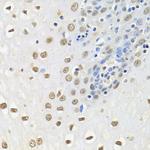 HuR Antibody in Immunohistochemistry (Paraffin) (IHC (P))