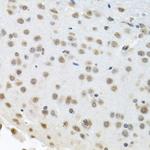 HuR Antibody in Immunohistochemistry (Paraffin) (IHC (P))