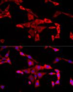 FMRP Antibody in Immunocytochemistry (ICC/IF)