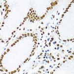 SAM68 Antibody in Immunohistochemistry (Paraffin) (IHC (P))