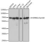 SAM68 Antibody in Western Blot (WB)